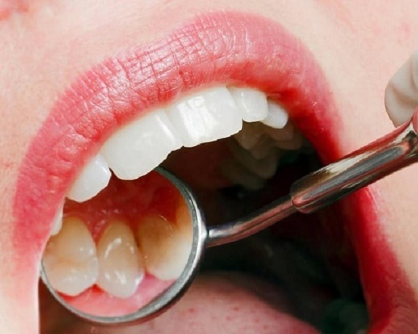 Causes and Symptoms of Paradontosis Symptoms of Paradontosis