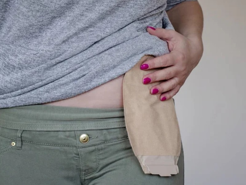 ostomy bags easy to wear