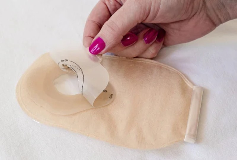 Ostomy bags can allow you to live a full, active life