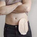 stoma